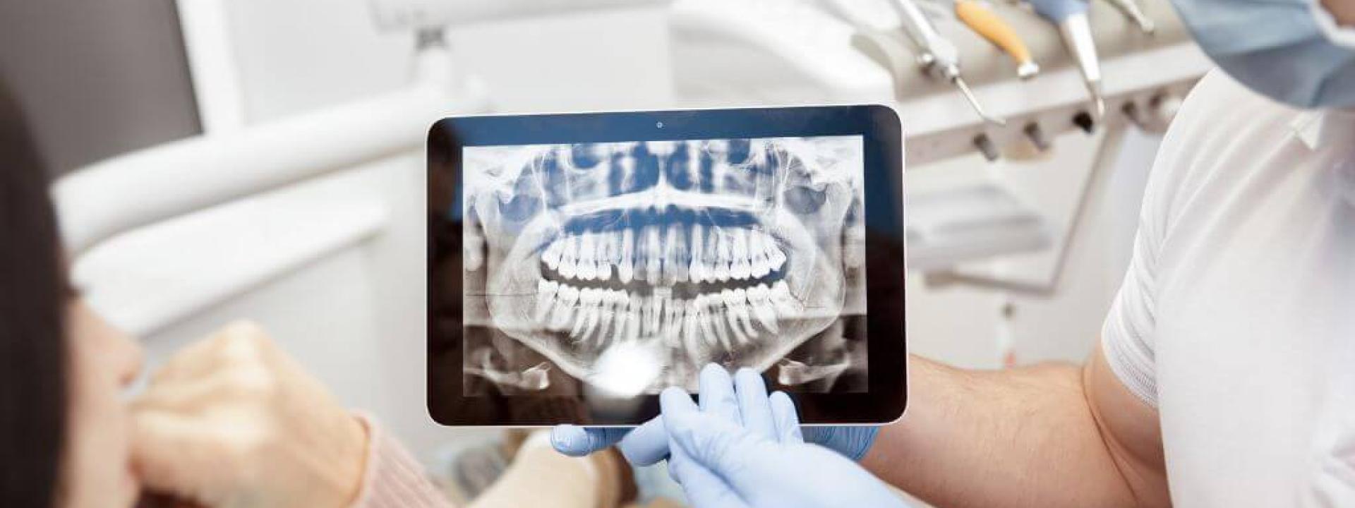 Are Dental X-Rays Safe Are Dental X-Rays Safe